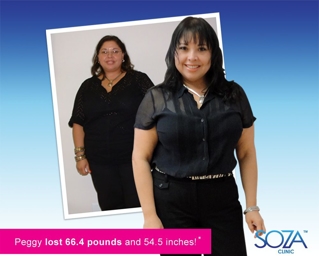 Before & After Photo